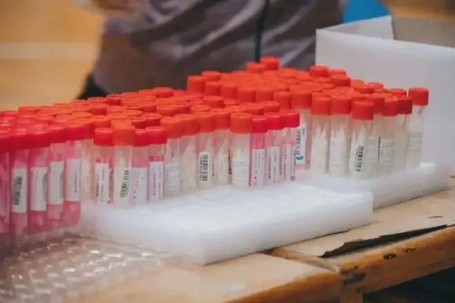 北京昨日新增1例死亡病例 为87岁男性