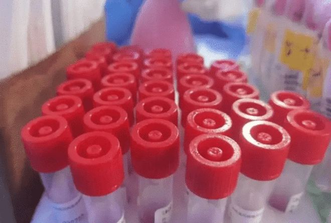 北京发布新冠阳性感染者社区健康管理专家指引